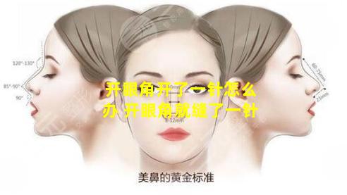 开眼角开了一针怎么办 开眼角就缝了一针